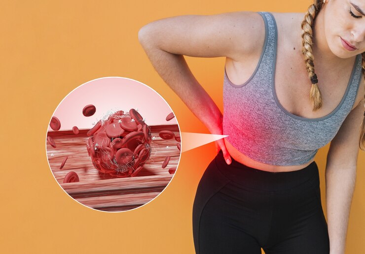 Understanding Inflammation and Its Impact on the Body